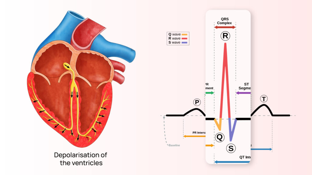 Understanding QRS Complex Abnormalities in Cardiac Health