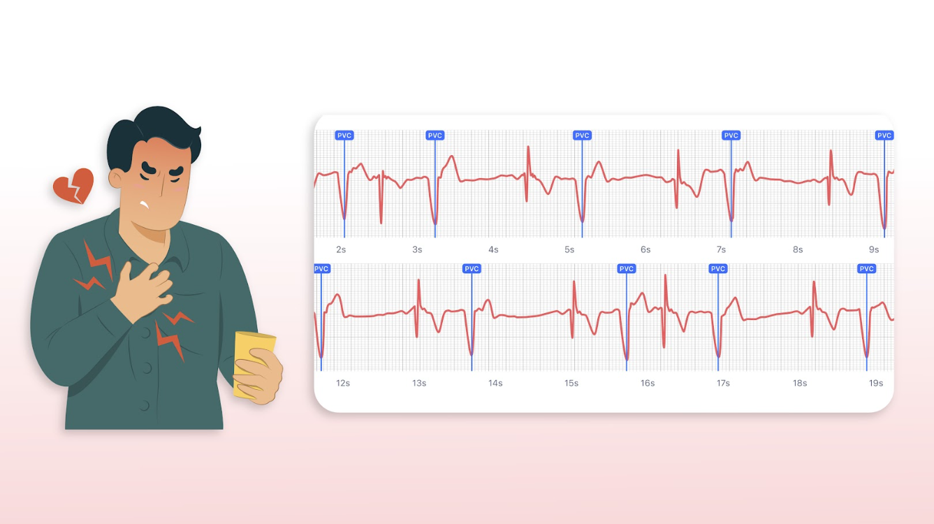 Heart Palpitations are frequent? Know when to seek help