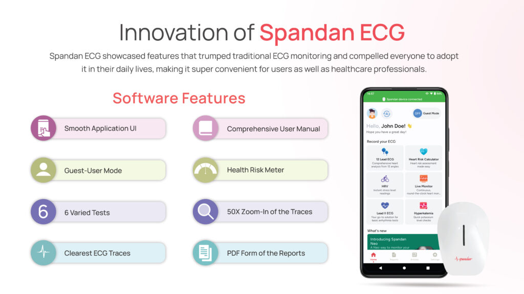 Spandan ECG Features: Innovation of the Portable ECG Machine