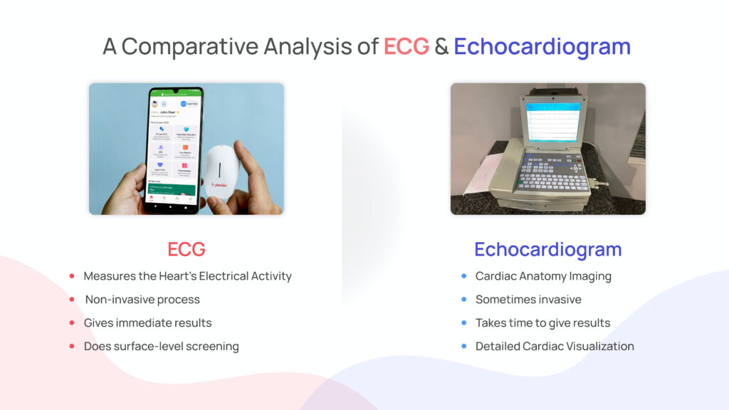 Decoding ECG vs Echocardiogram: A Comparative Analysis