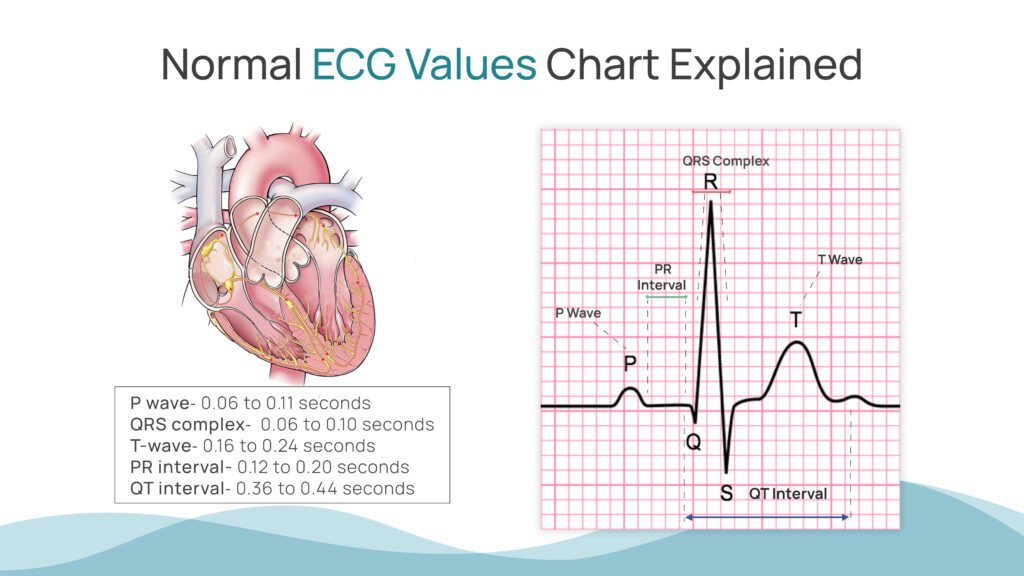 Normal ECG Values Chart Explained