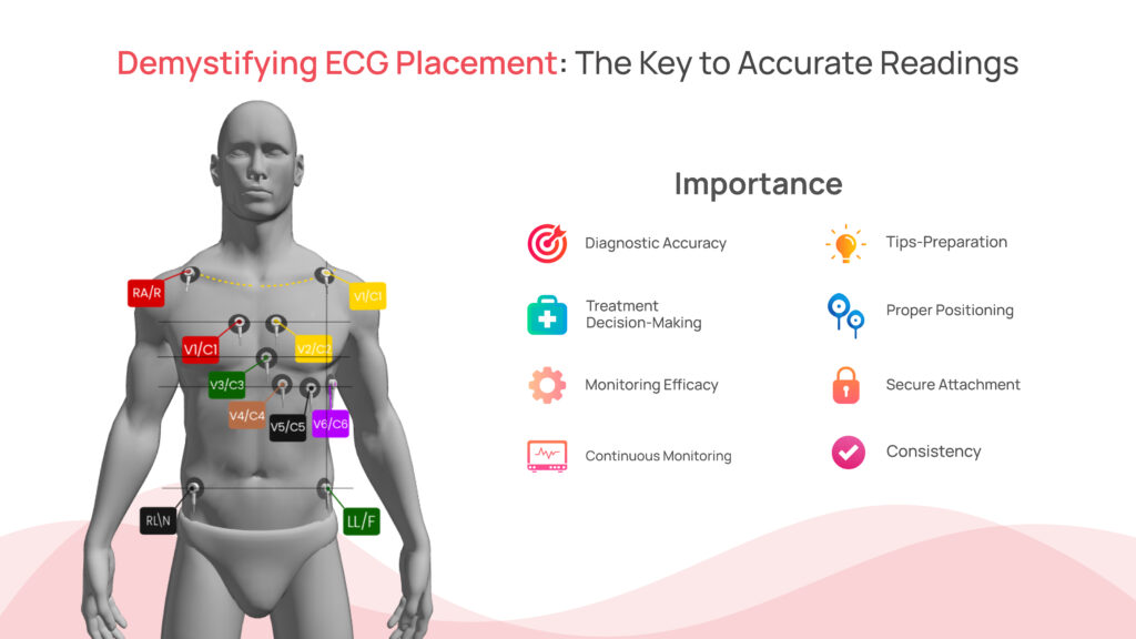 Demystifying ECG Placement: The Key to Accurate Readings
