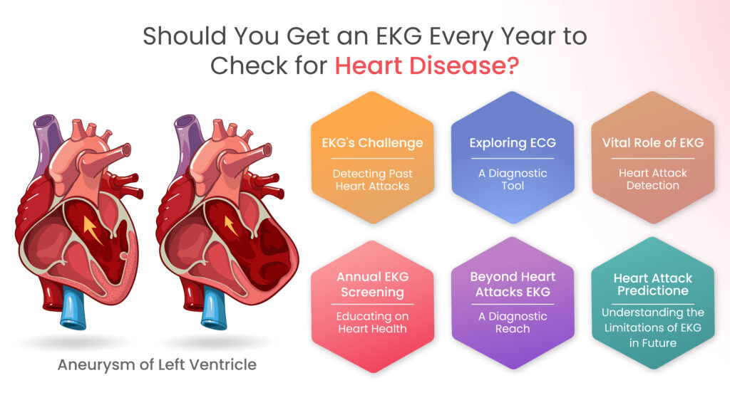 Should You Get an EKG Every Year to Check for Heart Disease?