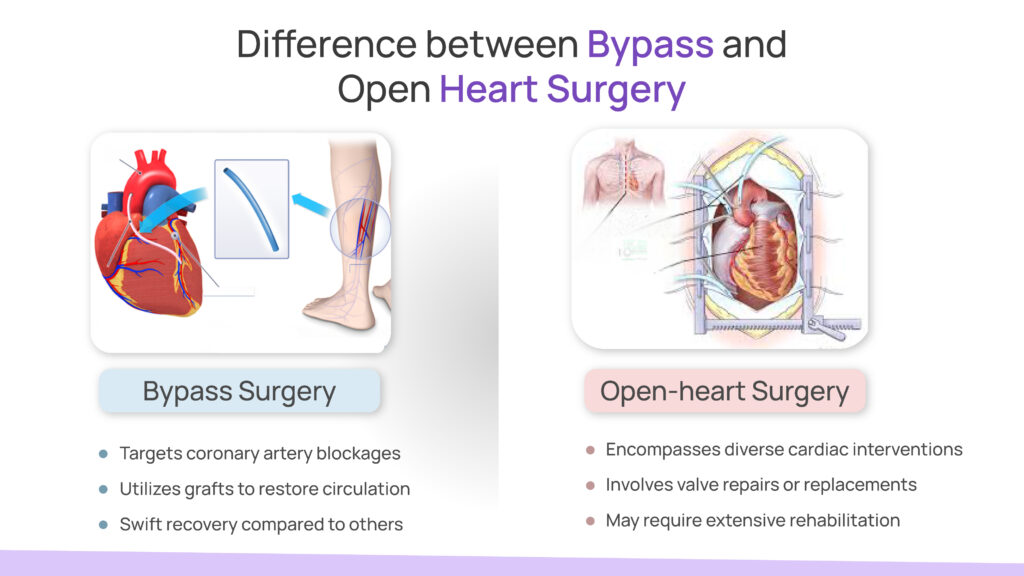 Difference between Bypass and Open Heart Surgery?