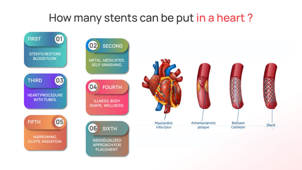 How many Stents can be put in a Heart?