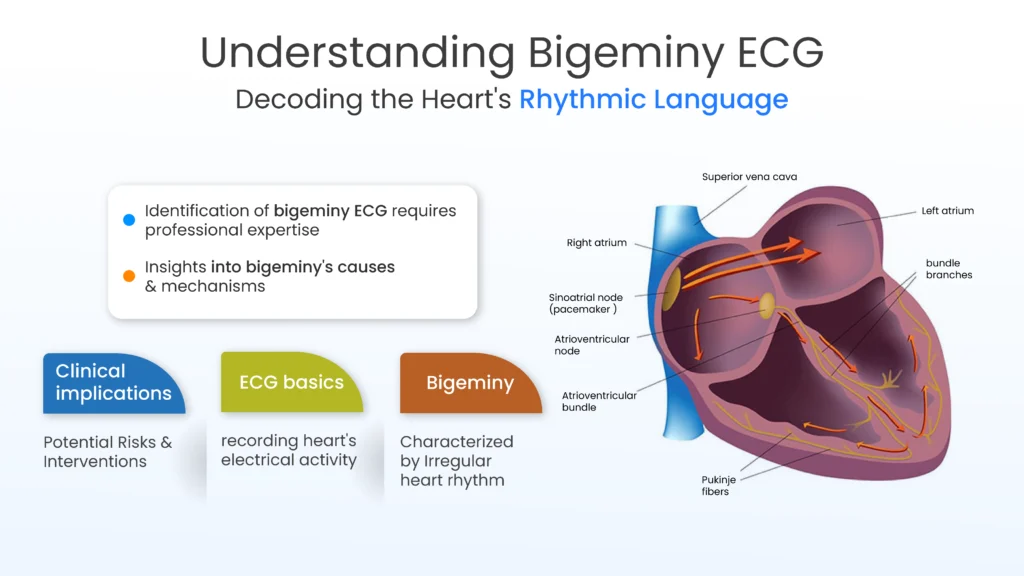 Understanding Bigeminy ECG
