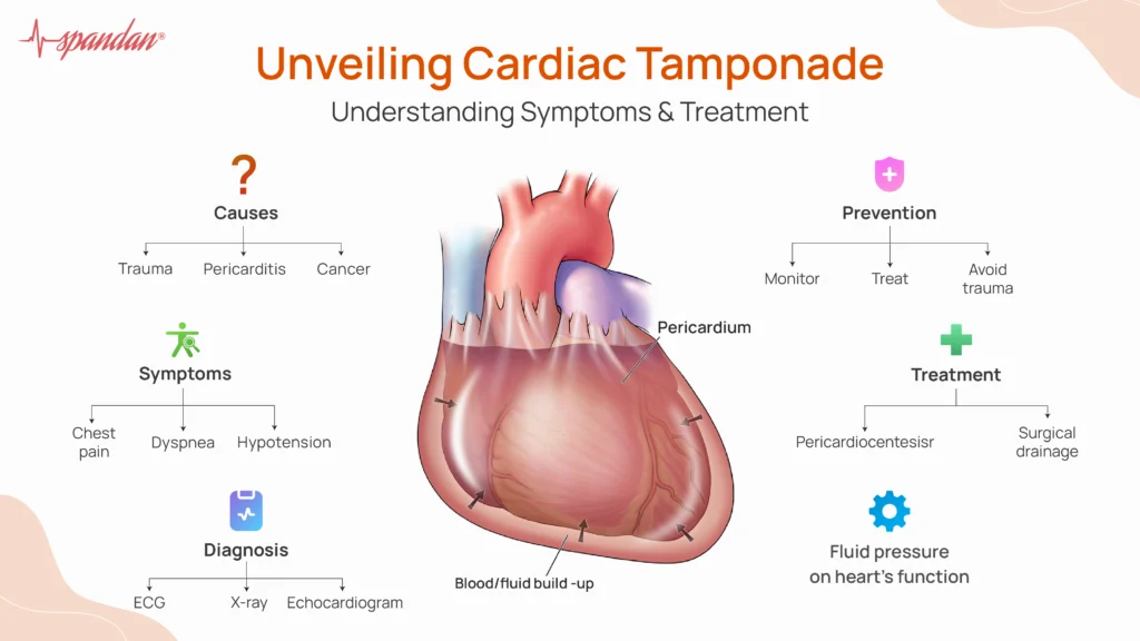 Unveiling Cardiac Tamponade: Understanding Symptoms &amp; Treatment