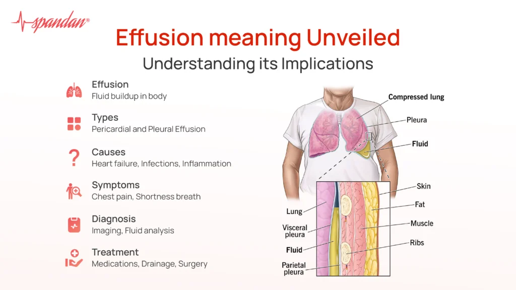 Effusion meaning Unveiled: Understanding Its Implications