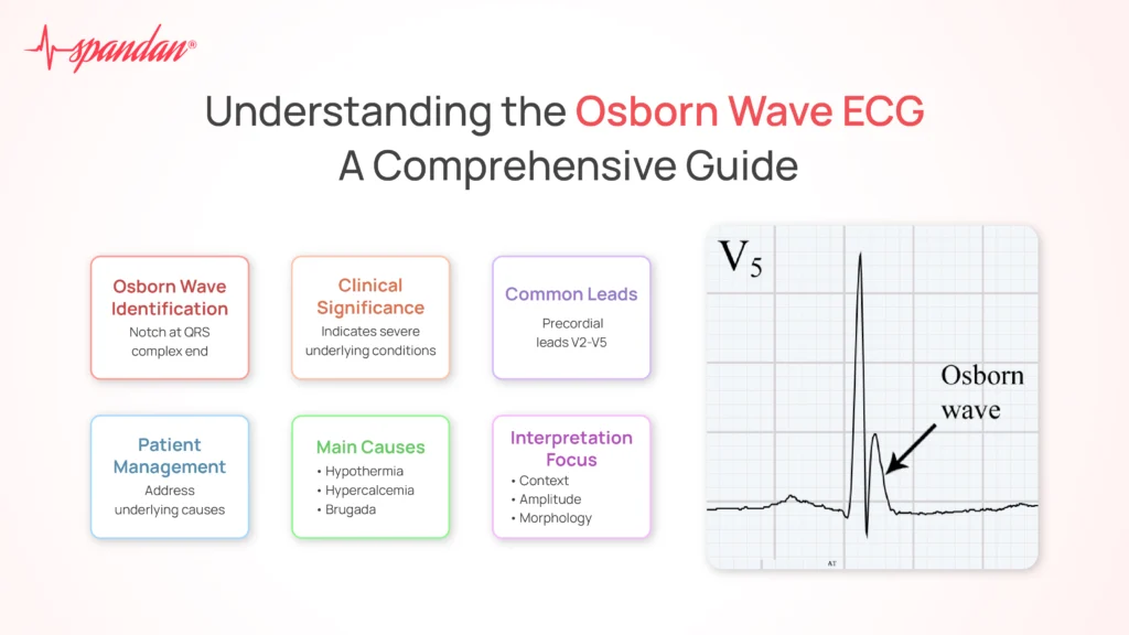 Understanding the Osborn Wave ECG: A Comprehensive Guide