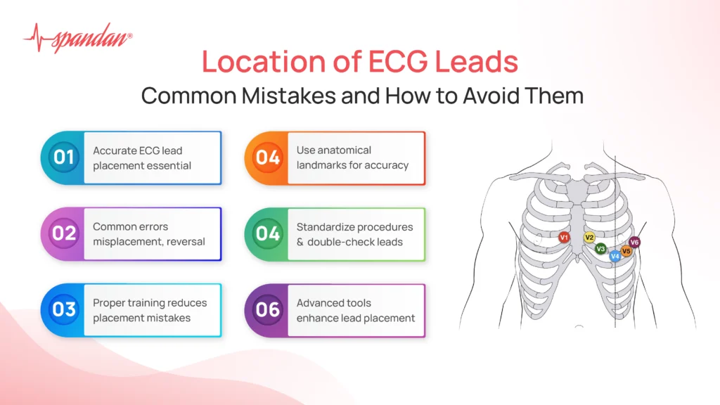 Location of ECG Leads: Common Mistakes and How to Avoid Them