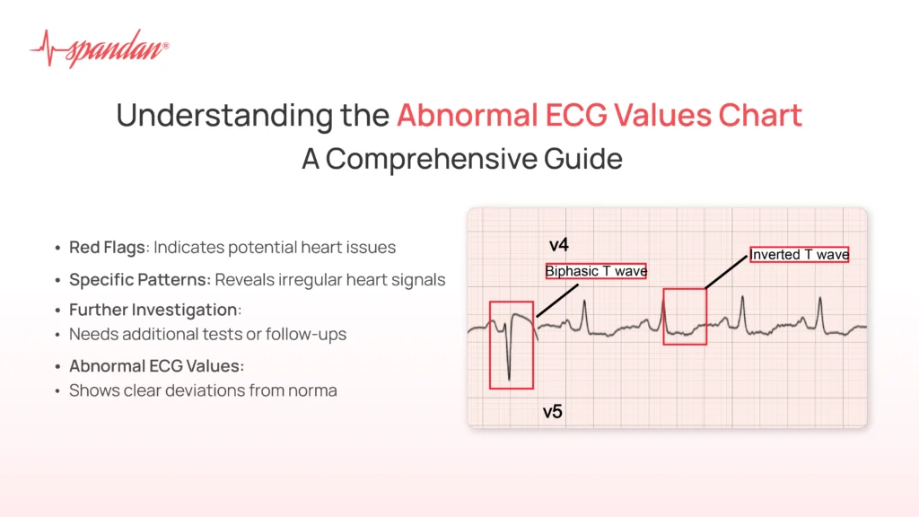 Understanding the Abnormal ECG Values Chart: A Comprehensive Guide