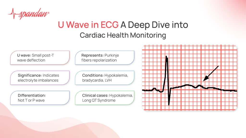 U Wave in ECG: A Deep Dive into Cardiac Health Monitoring