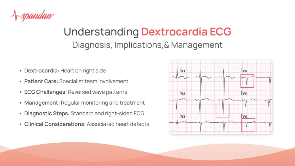 Understanding Dextrocardia ECG: Diagnosis, Implications, and Management