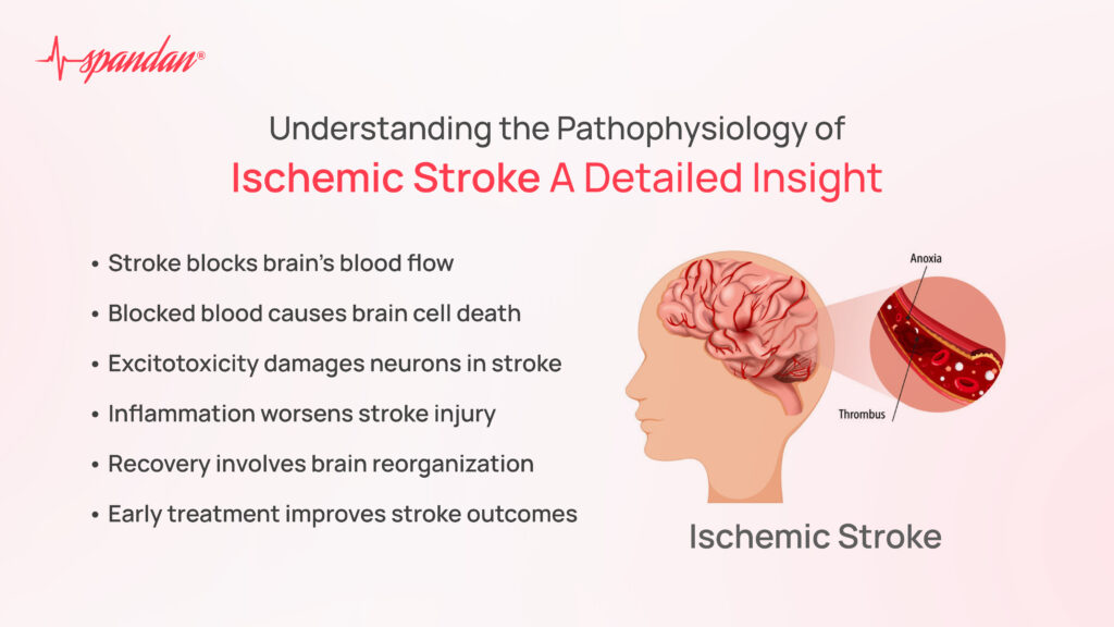 Understanding the Pathophysiology of Ischemic Stroke: A Detailed Insight