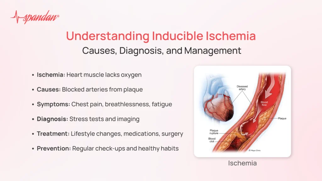 Understanding Inducible Ischemia: Causes, Diagnosis, and Management