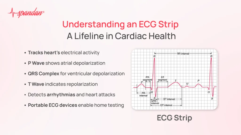 Understanding an ECG Strip: A Lifeline in Cardiac Health