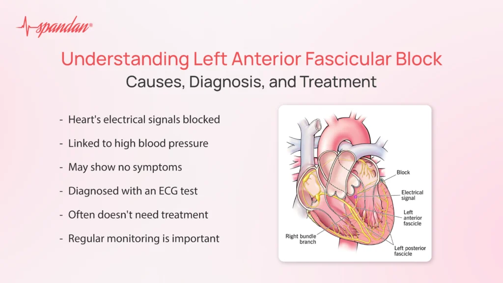 Left Anterior Fascicular Block: Causes,Diagnosis & Treatment
