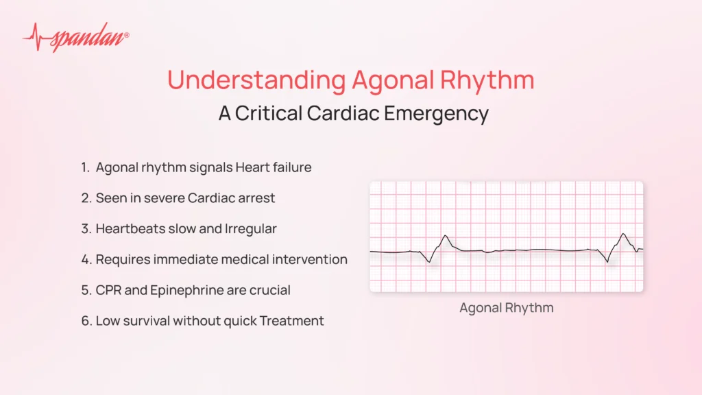 Understanding Agonal Rhythm: A Critical Cardiac Emergency