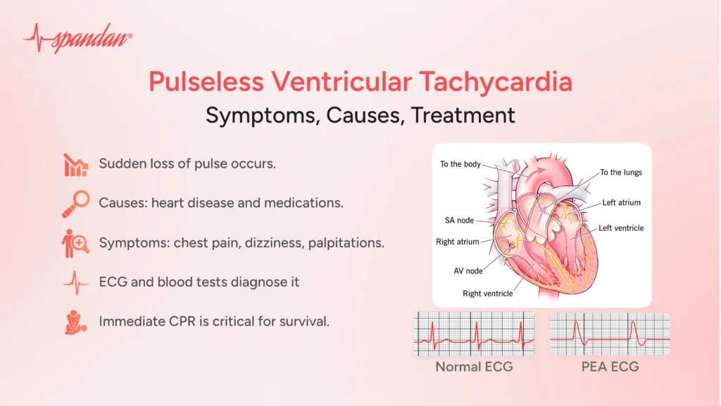 Pulseless Ventricular Tachycardia: Symptoms, Causes, Treatment