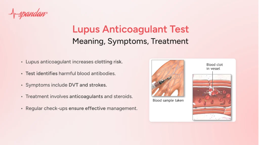 Lupus Anticoagulant Test: Meaning, Symptoms, Treatment