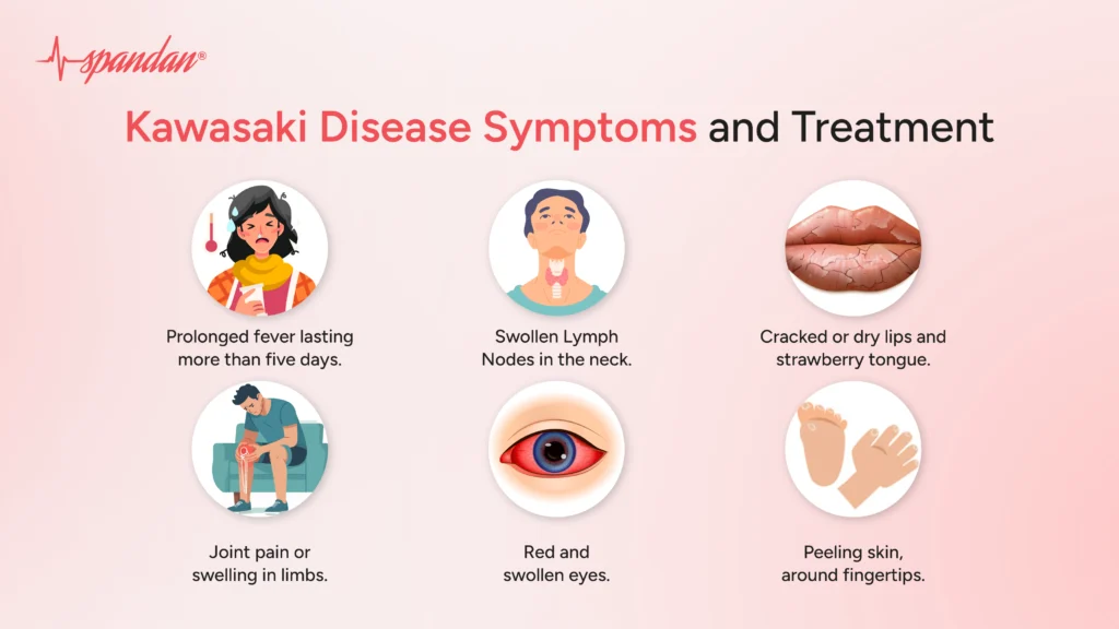 Kawasaki Disease Symptoms and Treatment