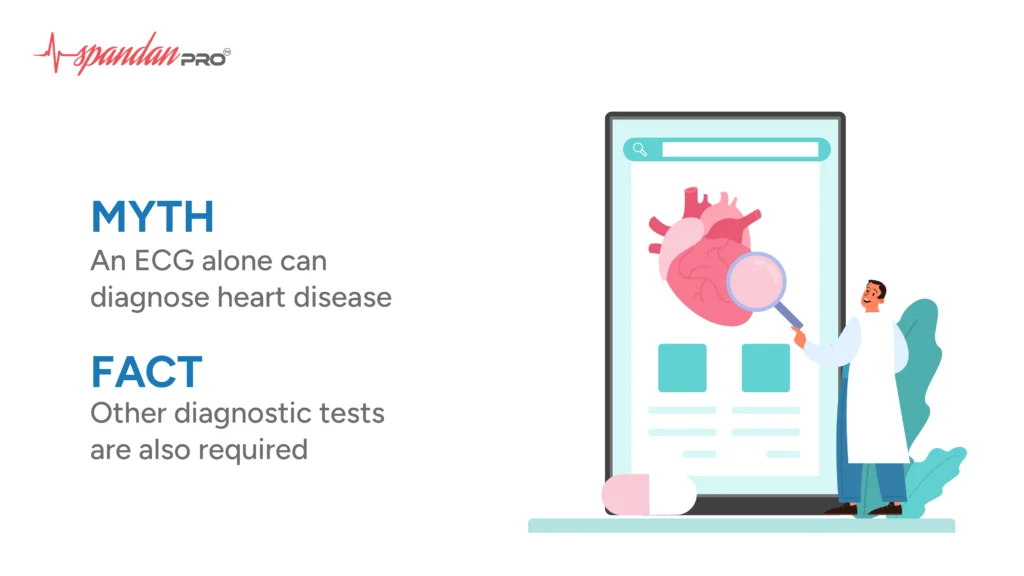 common myth about ECG