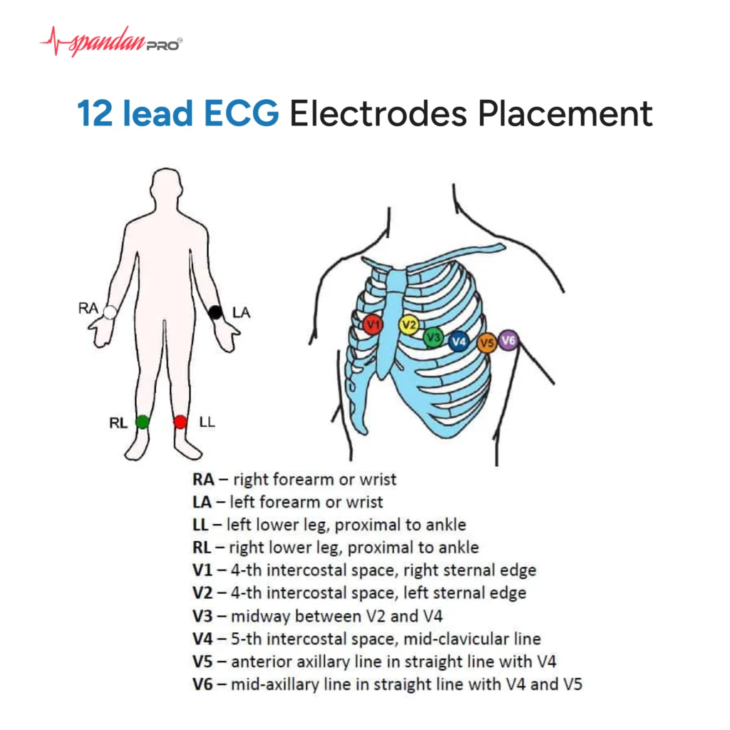 12 lead ecg Placement