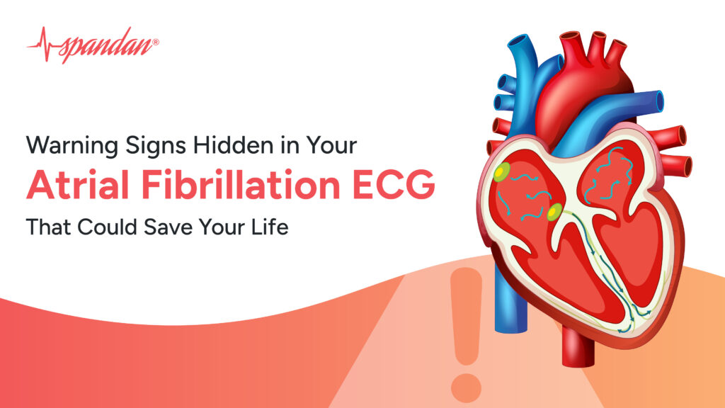 Warning Signs Hidden in Your Atrial Fibrillation ECG That Could Save Your Life