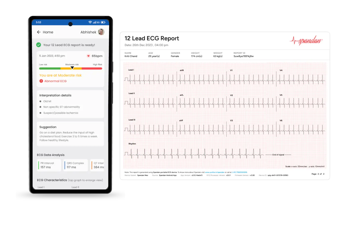 12-lead-ecg